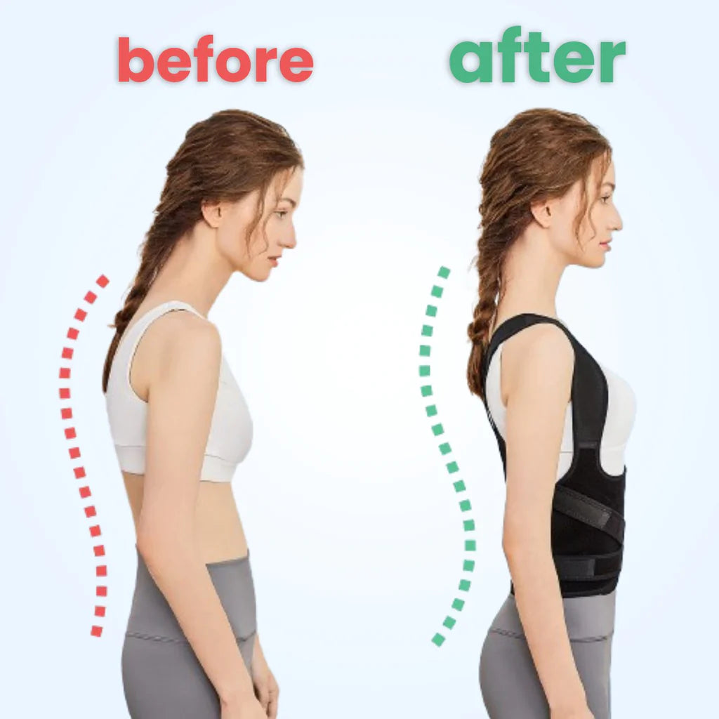 Revitalize Posture Corrector
